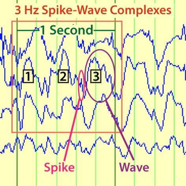 three hz and two hz with autocorrelation show beneath